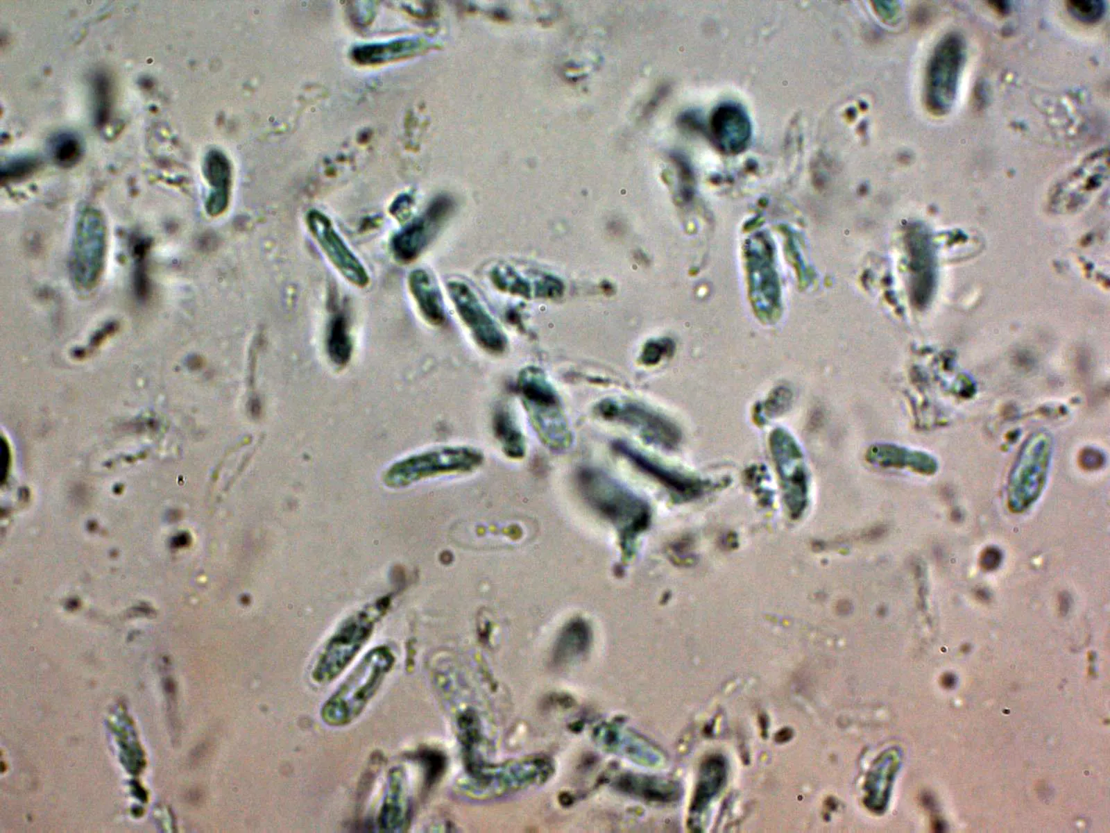 10 - Esporas Azul Cresilo 2